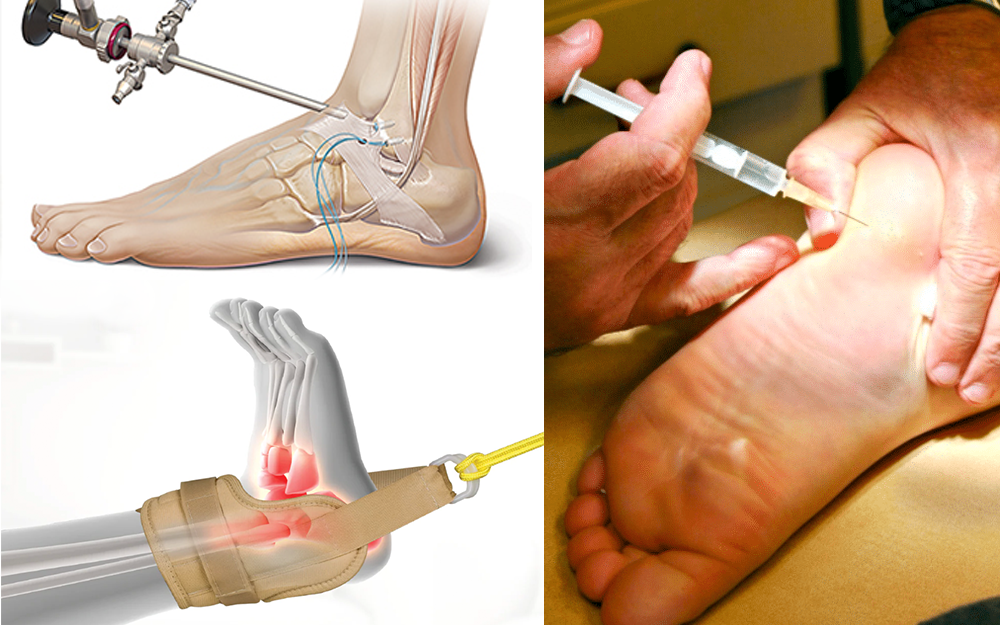 Akusoli magnetic acupressure insoles with reflexology mapping next to sneakers